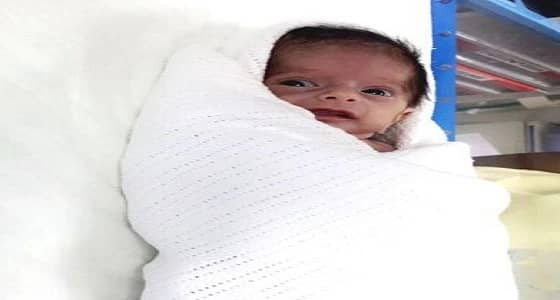 أطباء " حفر الباطن " تعيد ابتسامة " مياسة " من جديد