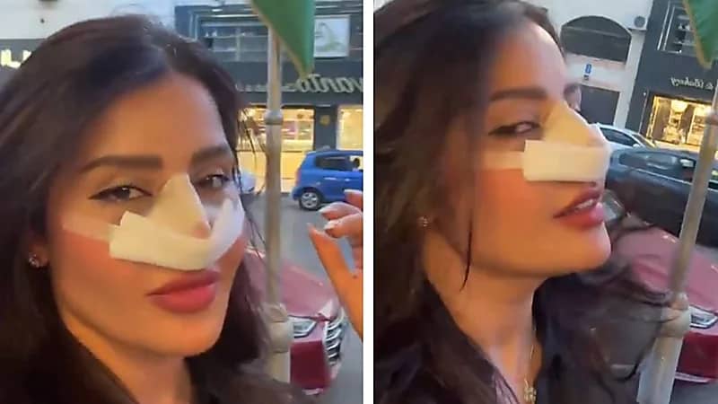 بدور البراهيم تثير الجدل بعد عملية تجميل أنف جديدة .. فيديو
