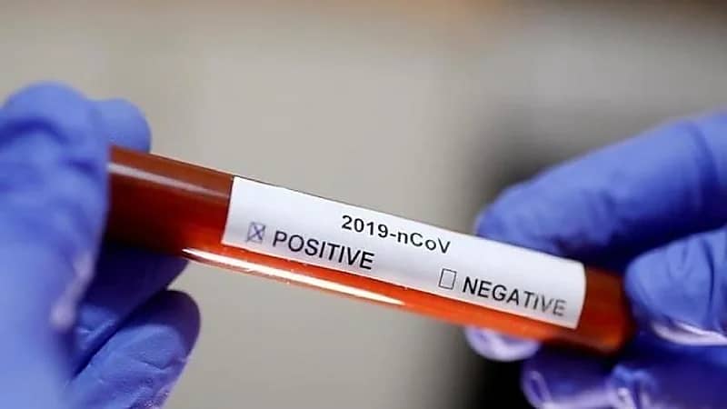 حقيقة العلاقة بين فصائل الدم وكورونا