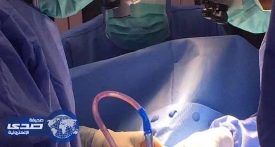 نجاح عمليتي استئصال أورام لمريضتين بمستشفى الملك عبدالعزيز التخصصي بالجوف