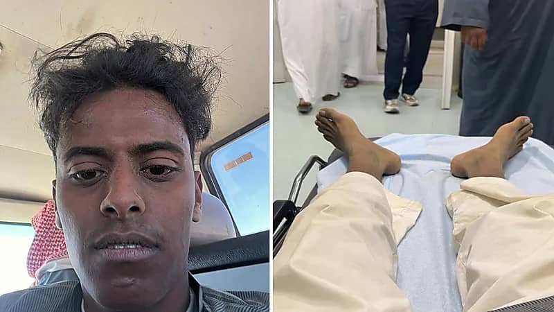 قعيد المجد يتعرض لحادث مروري ويطمئن متابعيه.. فيديو