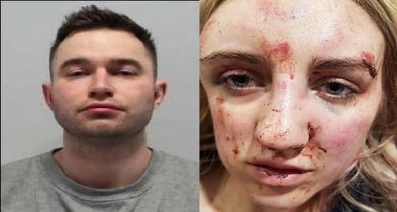 بالصور.. صديق يشوه وجه حبيبته ويضربها أمام ابنتهما