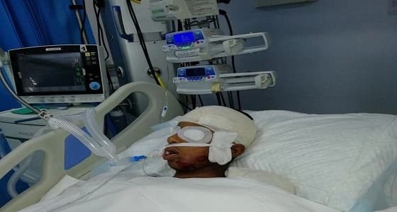 قائد متهور يصيب حدث بوفاة دماغية في جازان