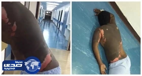 " حارقة زوجها " بالزيت المغلي ترفع دعوى سب وتشهير ضده