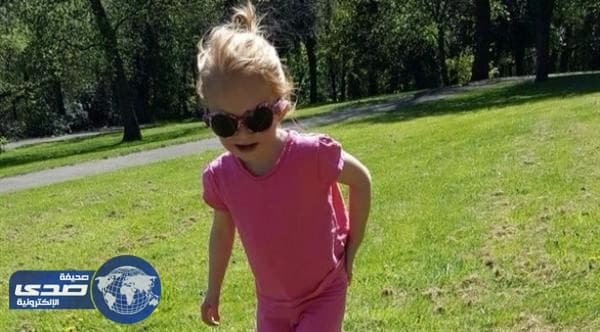 بسبب عيب وراثي ..طفلة تعيش على النظارات الشمسية