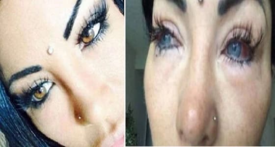 بالصور.. نهاية مأساوية لعارضة أزياء حاولت تغيير لون عينيها