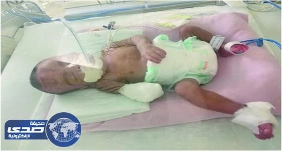 والد رضيع جازان المبتور يده: وزارة الصحة لها دور في مأساتي