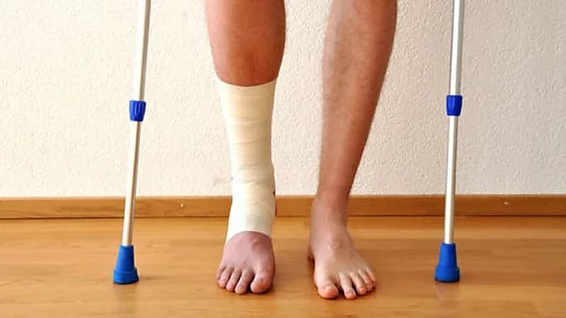 ابتكار صيني لمعالجة كسور العظام في 3 دقائق