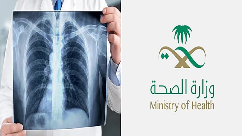 وزارة الصحة توجه نصائح لمرضى السل