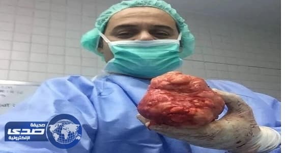 أطباء ينجحون في استئصال أورام عديدة من رحم امرأة بمستشفى حراء