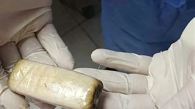 سجين يبتلع هاتف محمول ملفوف بكيس!