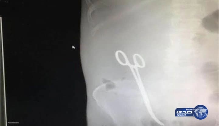 بالصور.. مراسم قرعة دورة شهداء الوطن الرمضانية بالمجاردة بمشاركة 16 فريقاً