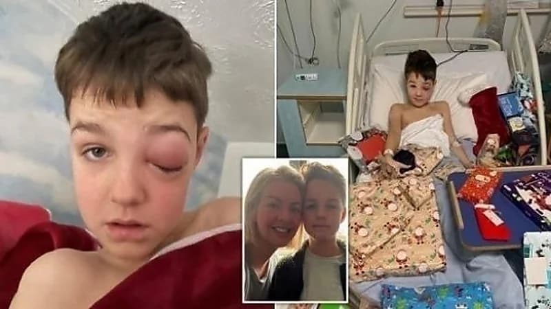 طفل يفقد بصره بسبب كورونا 