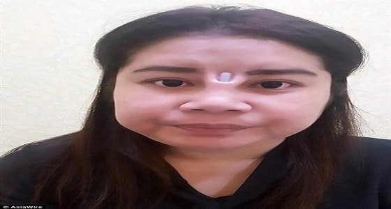 تشوه أنف فتاة بسبب عملية تجميل رخيصة
