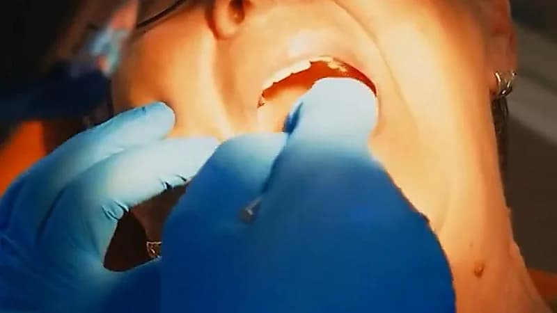 إهمال تنظيف الأسنان قد يضاعف خطر الإصابة بسرطان البنكرياس.. فيديو