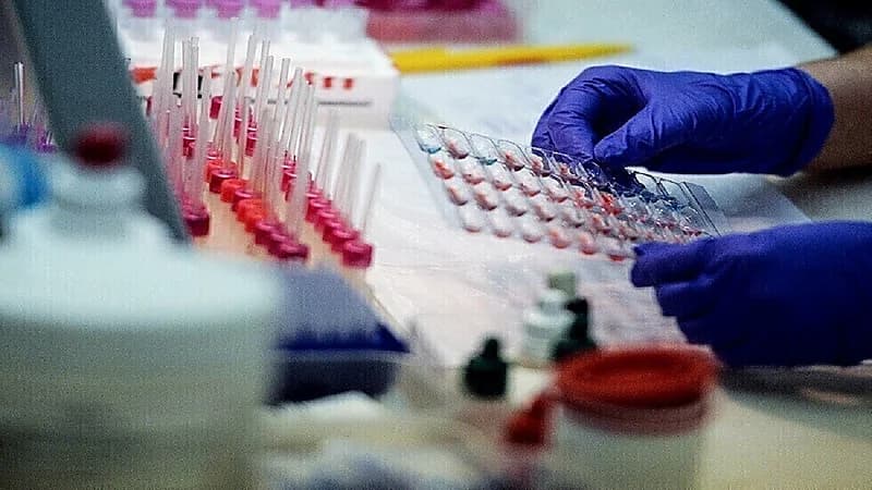 مرض يصيب الملايين حول العالم ويشبه أعراض كورونا