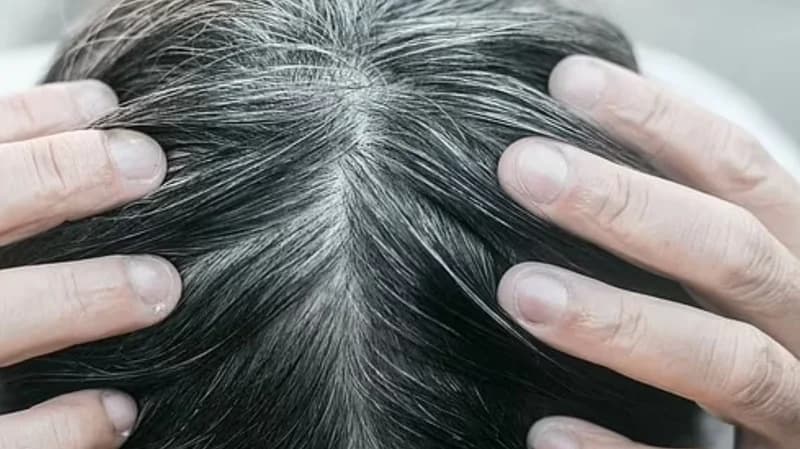 علماء يفسرون العلاقة بين التوتر والشعر الأبيض