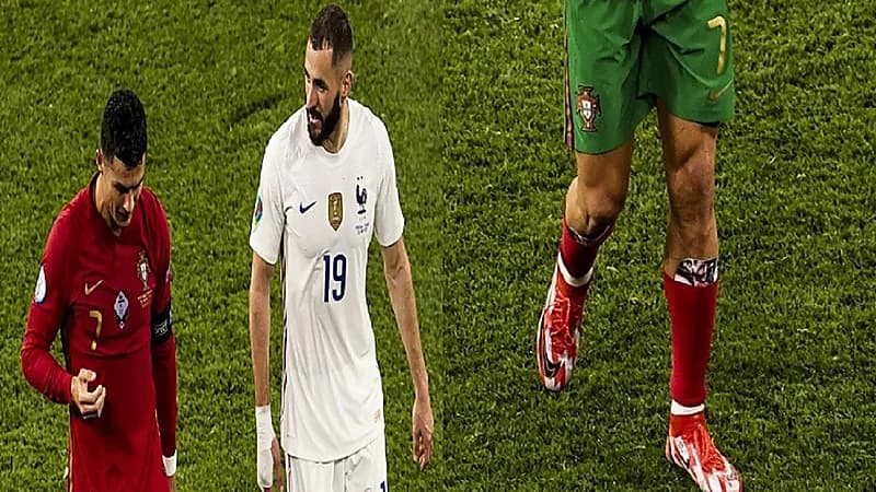 بالصور.. "رونالدو" يرتدي واقيًا للساق عليه صورته مع صديقته جورجينا