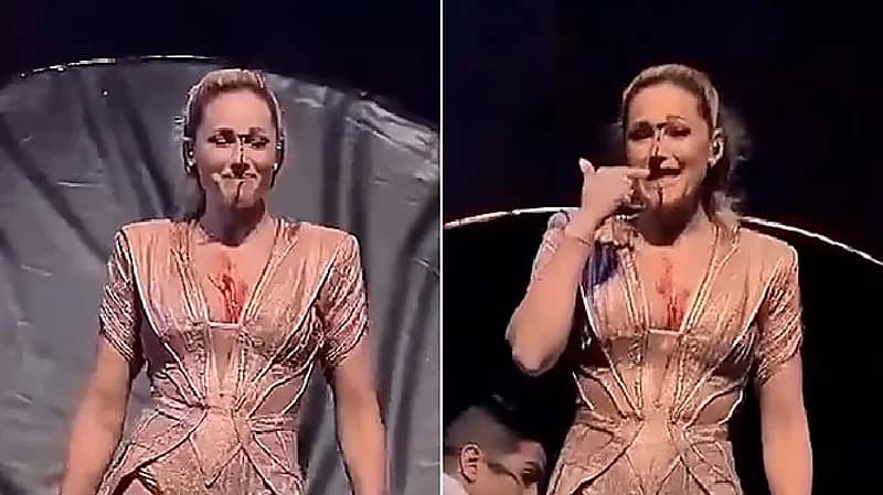 سقوط مروع لفنانة ألمانية أثناء عرض مسرحي.. صور