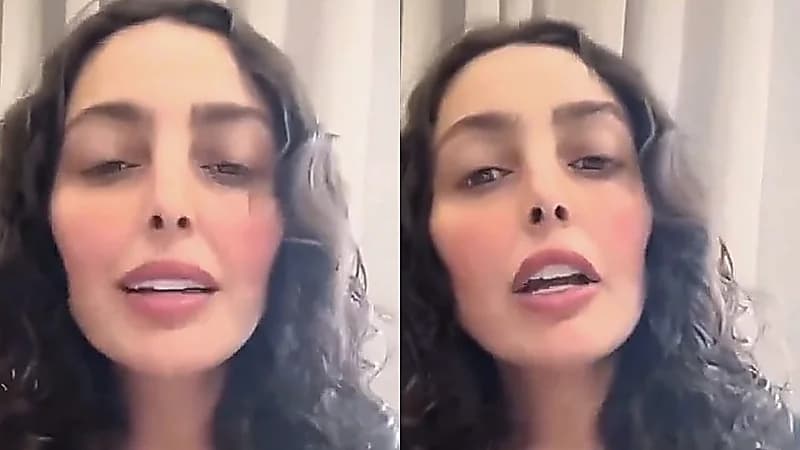 فاطمة الصفي: أنا ما سويت تكميم معدة أنا سويت قص لجلدي  ..  فيديو