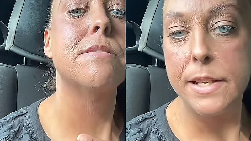 منتج تجميلي شهير يشوه وجه امرأة وتظهر بعمر الشيخوخة .. فيديو