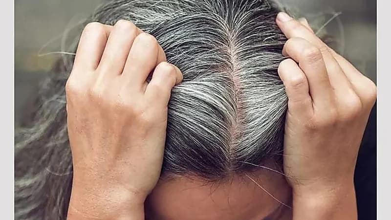 حقنة تزيل الشيب من الشعر تثير الجدل