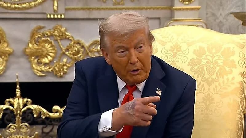 صور ليد ترامب تشعل التساؤلات: كدمات ومساحيق تجميل واضحة