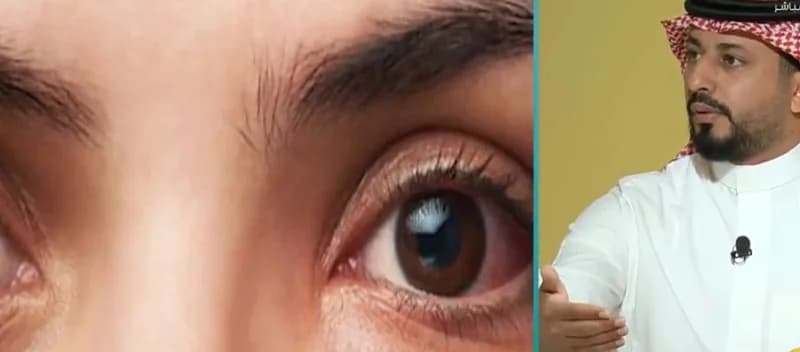 استشاري: المياه البيضاء ليست مرضًا والسكري أبرز مسبب لاعتلال الشبكية  .. فيديو