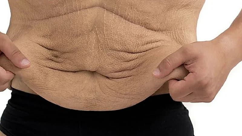 مختص يوضح أفضل أنواع التمارين لعلاج ترهلات الجسم