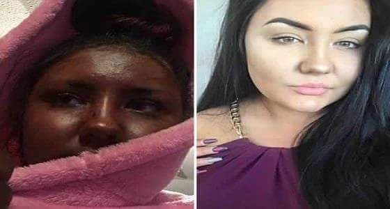 بالصور.. كريم بشرة يحول فتاة حسناء إلى غول