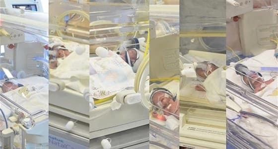 في حالة نادرة..أم لأربع أطفال تلد 6 توائم