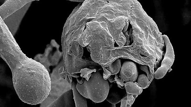 وفاة مصابة مصرية بالفطر الأسود رغم عدم إصابتها بـ«كورونا»