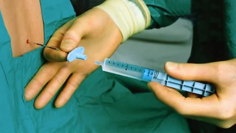 استشارية تكشف عن حقائق بشأن إبرة الظهر للولادة