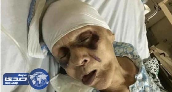 ابن عاق يعذب أمه المسنة حتى الموت إرضاءا لزوجته