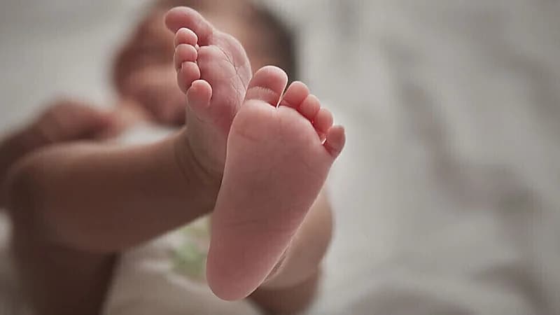 إزالة جنين من جمجمة أخته بعد عام من ولادتهما