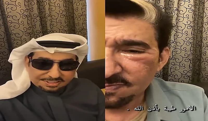شاهد.. السدحان يصدم جمهوره بوجه منتفخ 