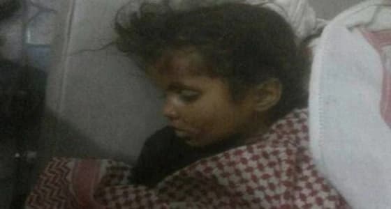 قناص حوثي يقتل طفلة يمنية شرق محافظة تعز جنوب البلاد