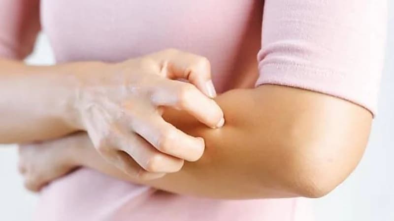 ما هي حساسية الطعام وأعراضها ؟