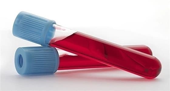 دراسة: هناك إيجابية وحيدة لزيادة الكوليسترول عند التقدم في العمر