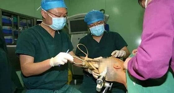 بالفيديو.. مقص يخترق جمجمة سيدة