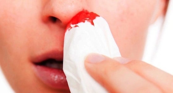 مواطنة تخترع آلة طبية لوقف النزيف دون الحاجة لمساعدة الآخرين