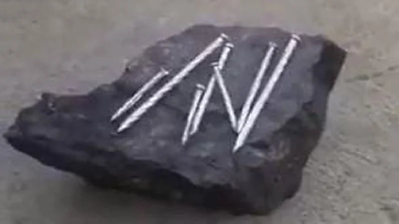 شاهد.. استئصال ورم مرتجع يزن ٣ كيلو من ظهر مريض