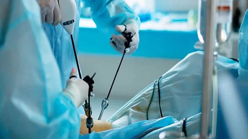 الذيابي يحسم الجدل بشأن إزالة الحصوات من المرارة بالمنظار دون استئصالها