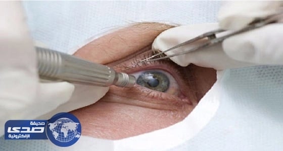 ⁠⁠⁠⁠شاب صينى يستعيد الرؤية بعينه اليمنى بعد زرع قرنية خنزير