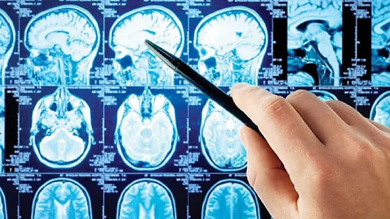 مختص: بصمة الدماغ أدق تقنية للكشف عن المجرمين