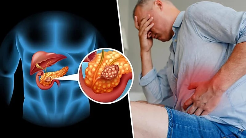 8 مؤشرات لسرطان البنكرياس الخطير