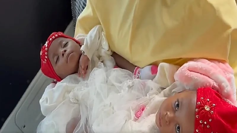 استعدادات نقل التوأم السيامي النيجيري "حسانة وحسينة" إلى الرياض..فيديو