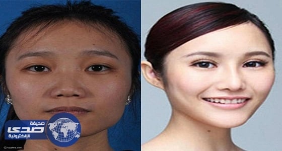 بالصور .. عمليات تجميل توقف صينيات بالمطار