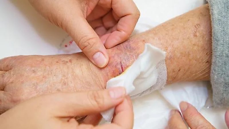 العلماء يطورون هلامًا كهربائيًا لعلاج الجروح الصعبة لدى مرضى السكري