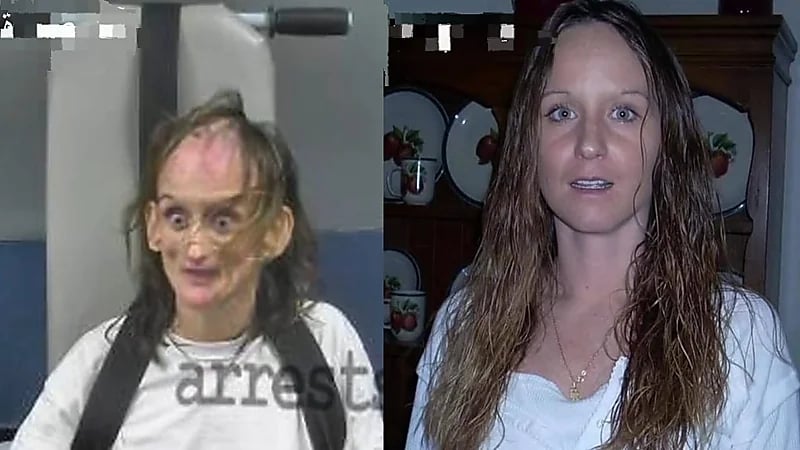 تحول مخيف لشكل امرأة بعد سنوات من الإدمان.. فيديو